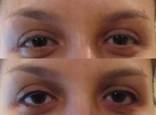 Second Eyeliner Before And After Picture