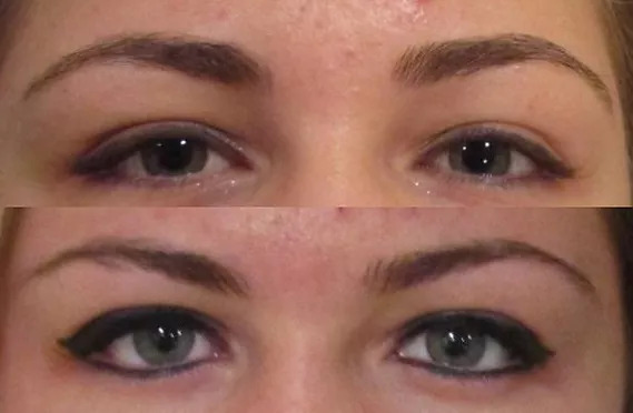 Third Eyeliner Before And After Picture
